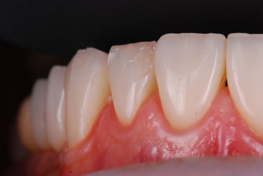 prace protetyczne Dental Scan