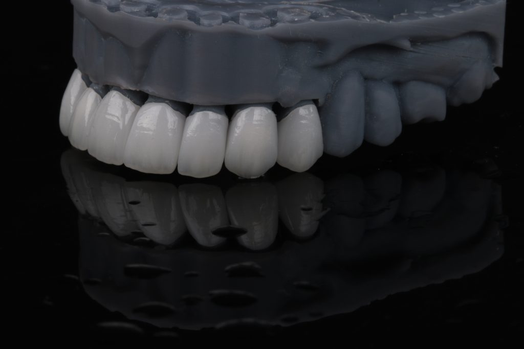 licówki cad cam
