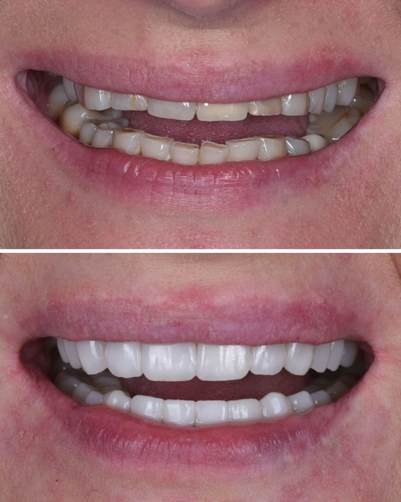 flow injection szyna wrocław