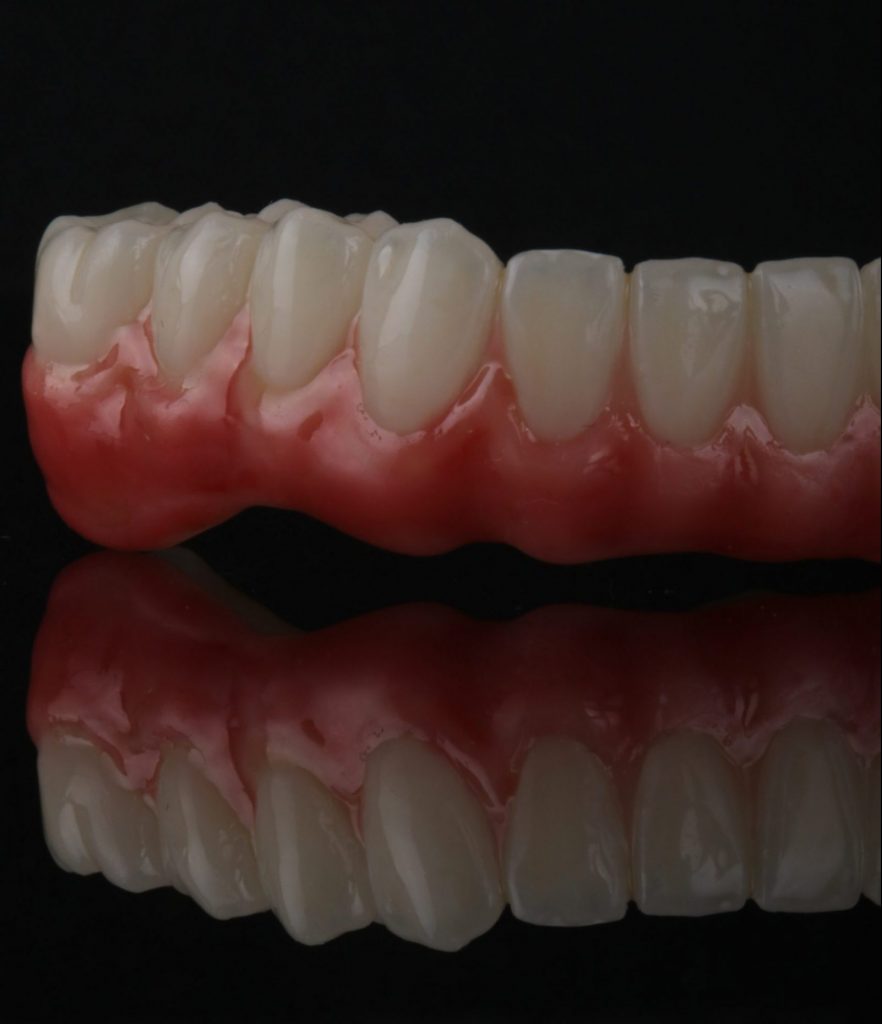 prace protetyczne online Dental Scan