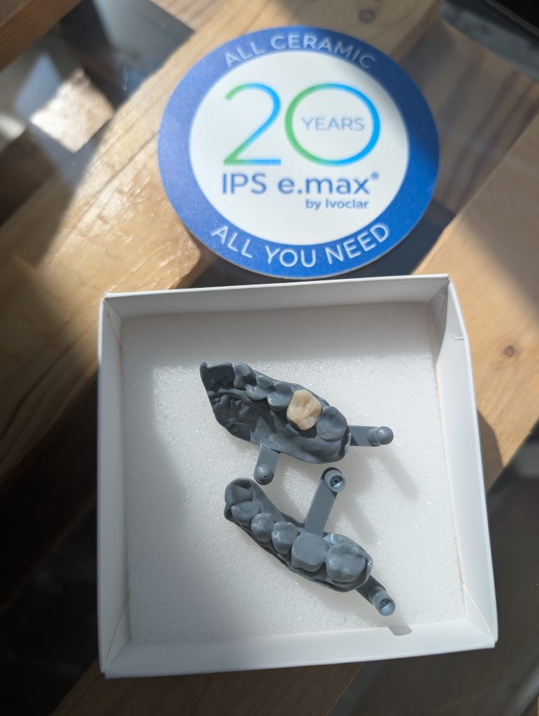 korony z pełnej ceramiki z laboratorium Dental Scan